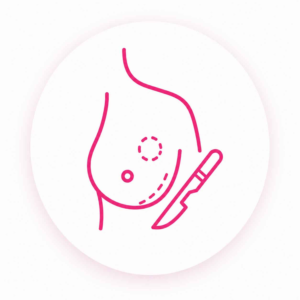 Breast lumps and breast surgeries