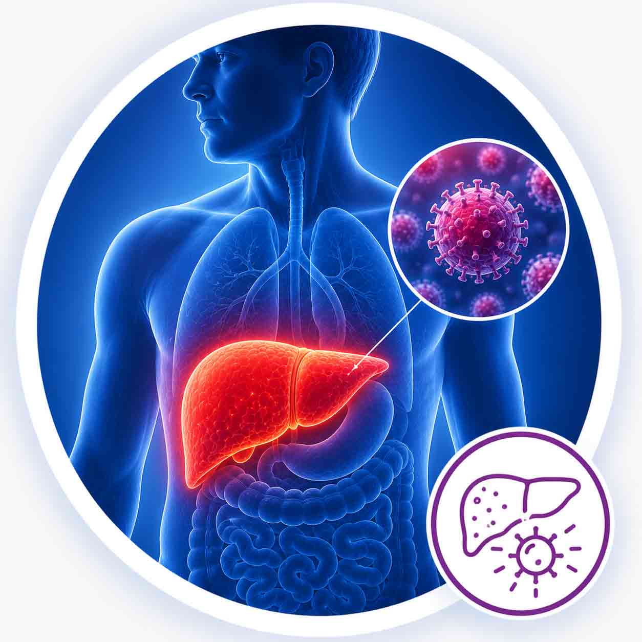 Hepatitis