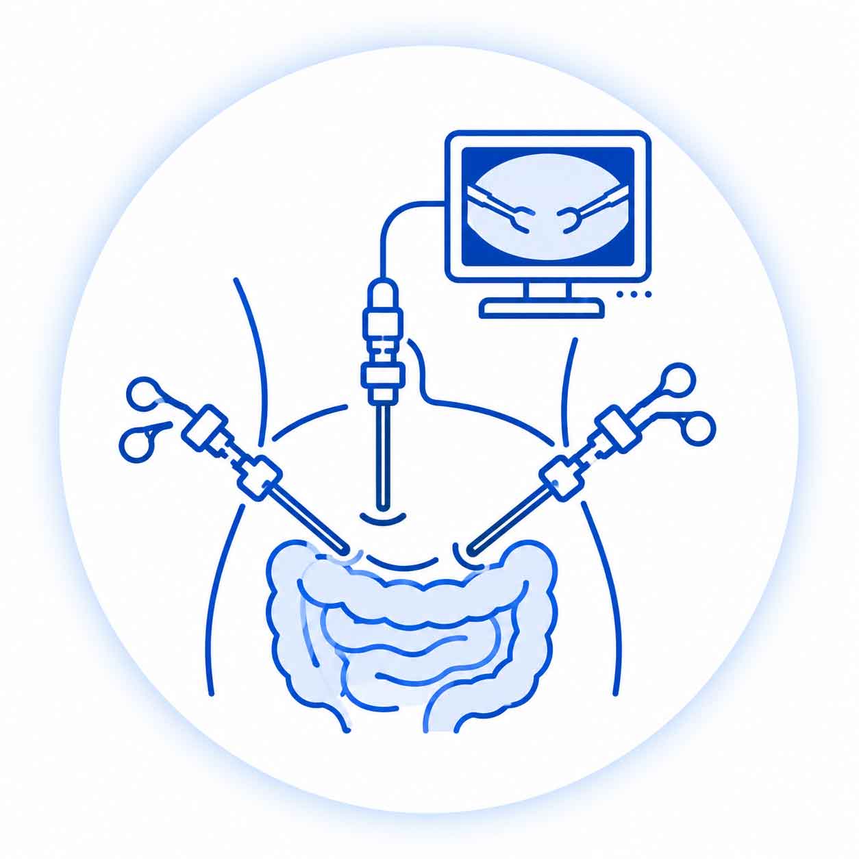 Laparoscopic and minimally invasive surgeries