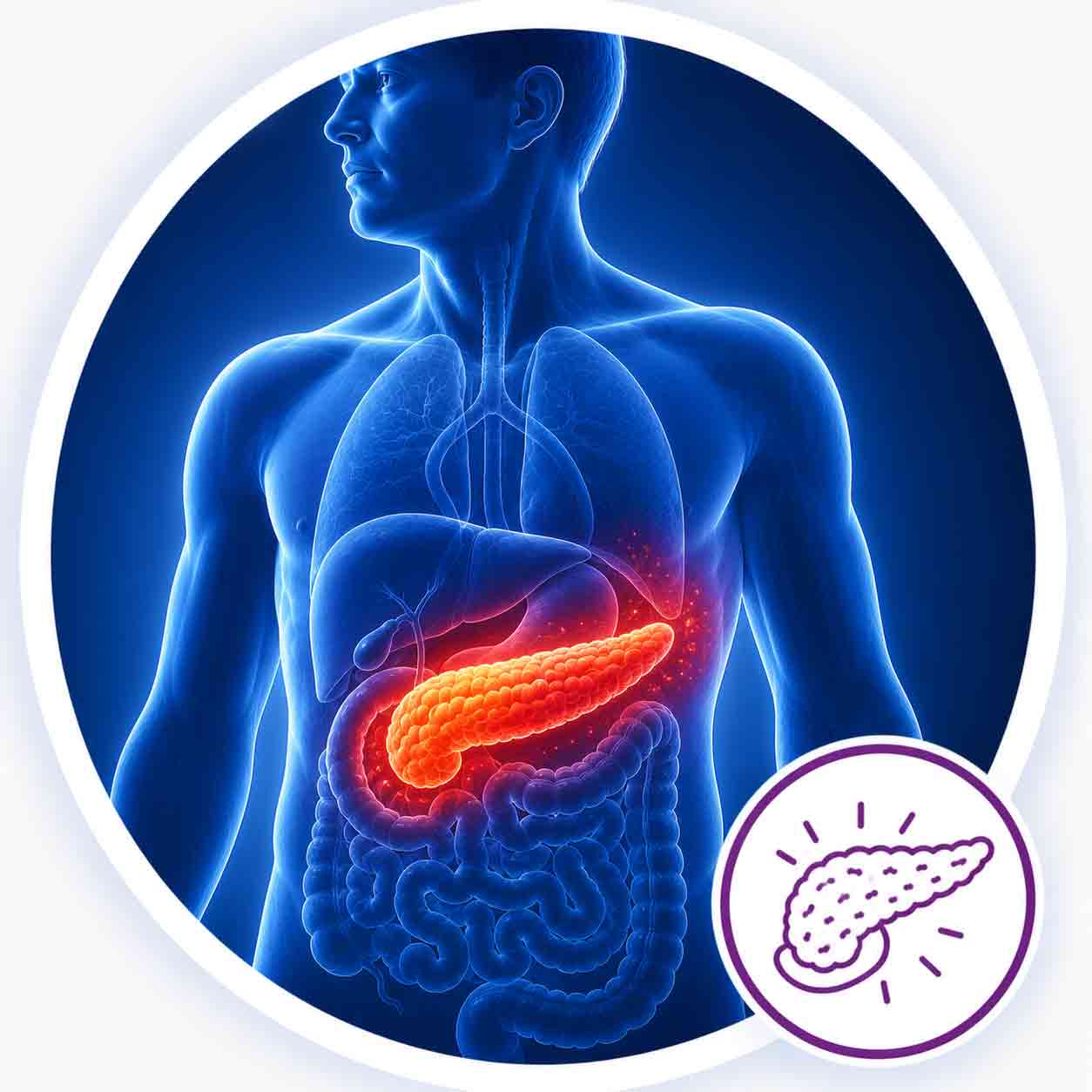 Pancreatitis